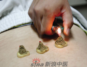 灸法的種類(lèi)  你知道多少？