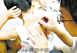 灸法的種類(lèi)  你知道多少？
